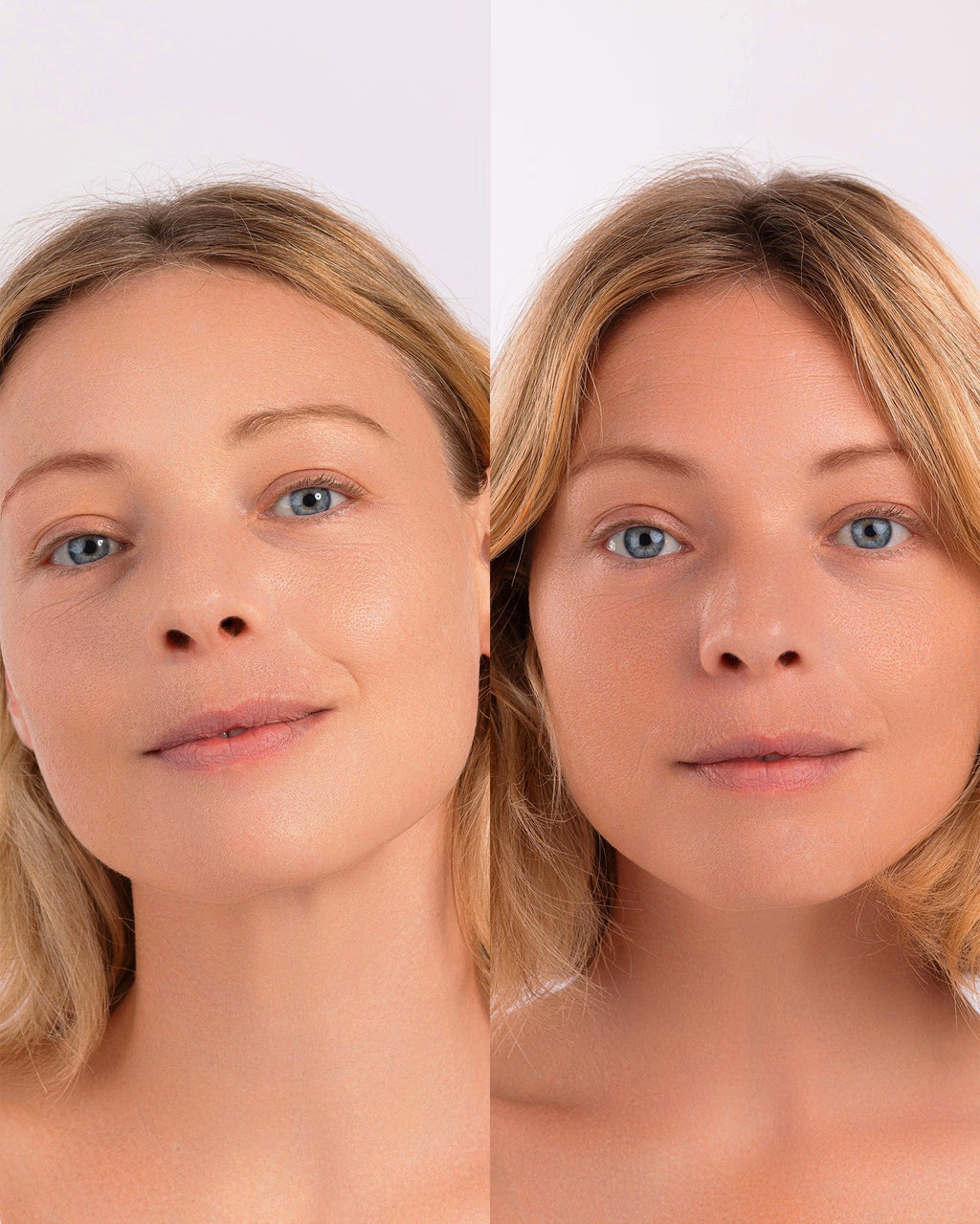 Soin Concentré Eclo